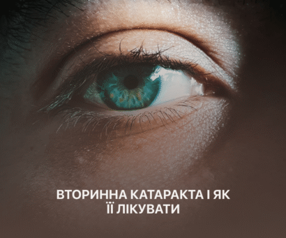 вторинна катаракта