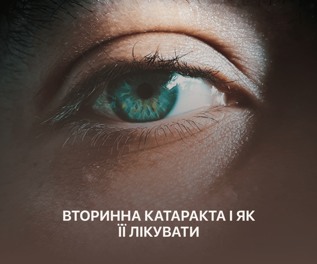 вторинна катаракта